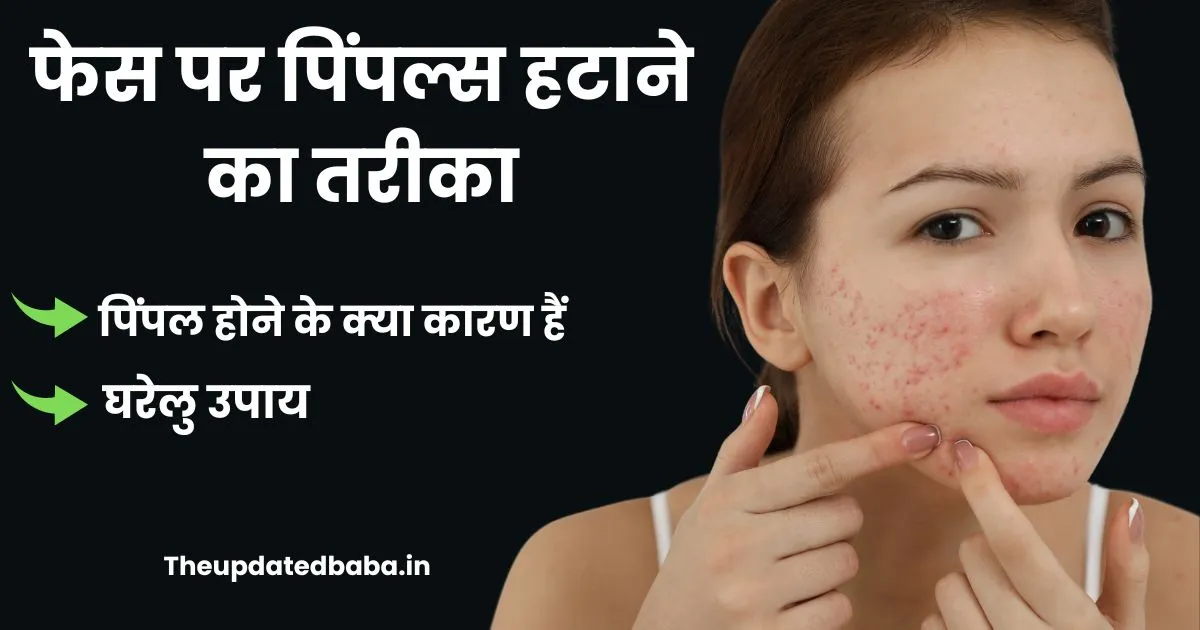 फेस पर पिम्पल हटाने का तरीका