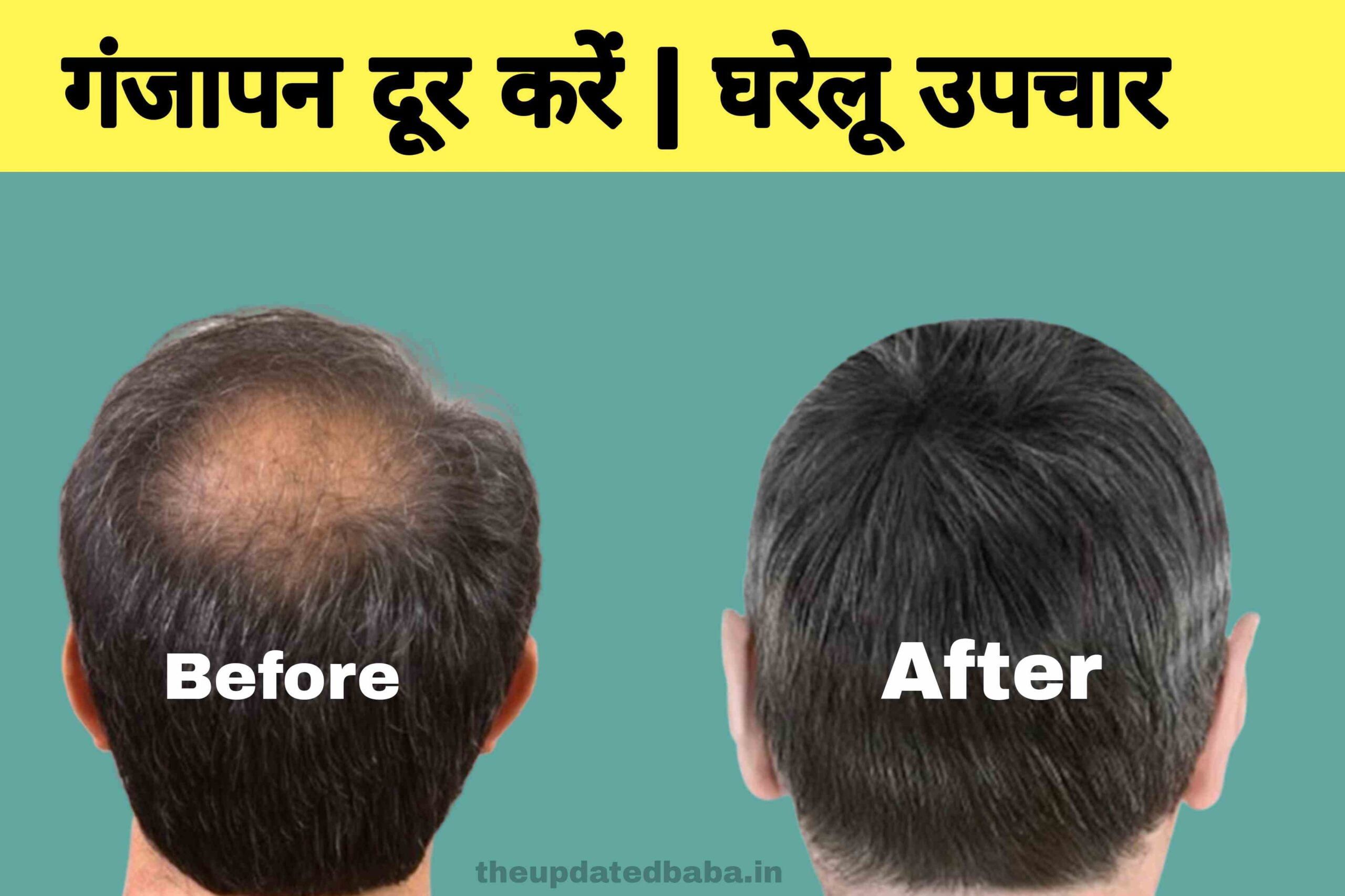 ganjapan kaise dur kare प्याज से गंजापन कैसे दूर करें